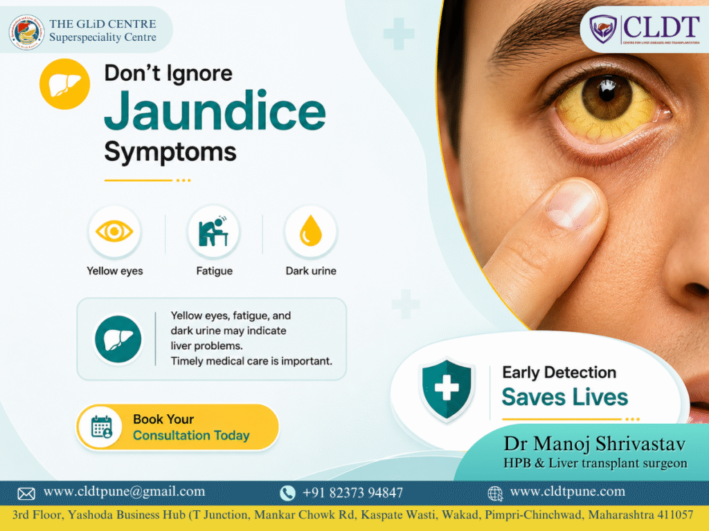 Jaundice symptoms including yellow eyes treated by Dr. Manoj Shrivastav, Liver Specialist and Liver Transplant Surgeon in Pune