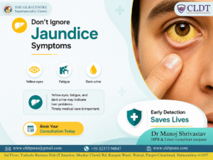 Jaundice symptoms including yellow eyes treated by Dr. Manoj Shrivastav, Liver Specialist and Liver Transplant Surgeon in Pune