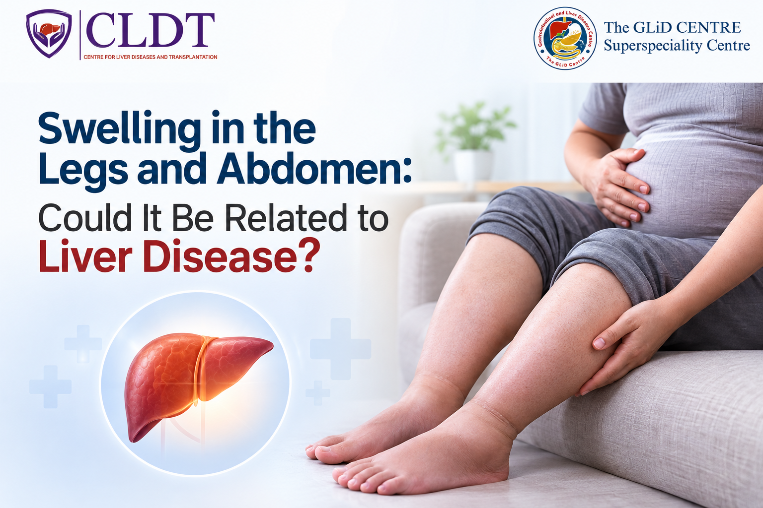 Swelling in legs and abdomen related to liver disease awareness