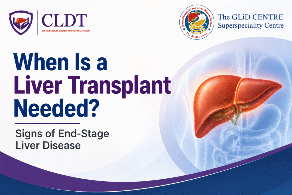 Liver transplant evaluation and signs of end-stage liver disease